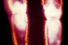 Kirlian photograph Fingertips
