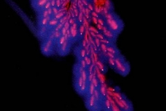 Kirlian photograph Kirlian 1